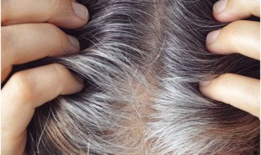 Gray Hair Tips: If you want to make white hair black again, then try these 5 home remedies!