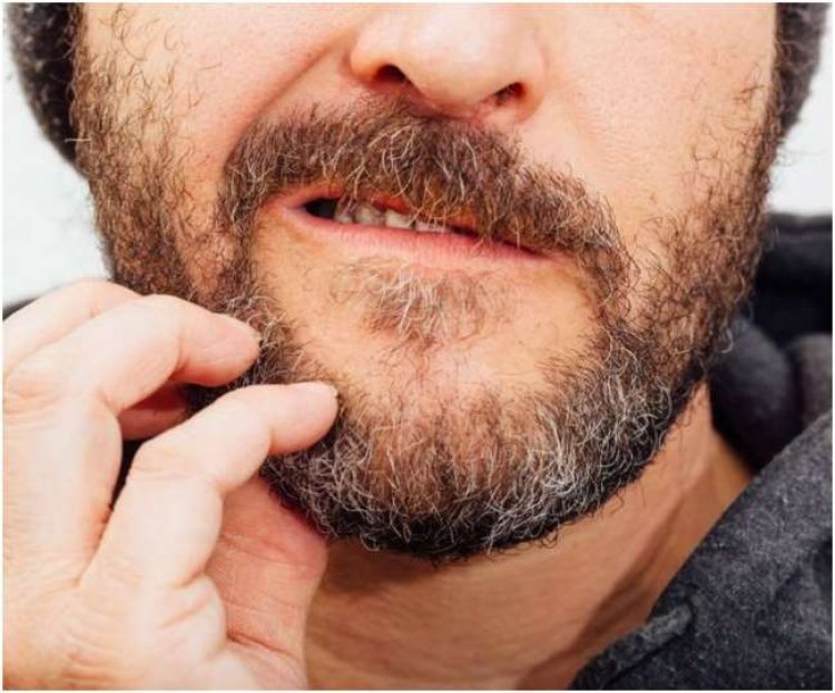 Beard Itching Tips: These 5 reasons cause itchy beard!