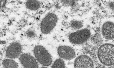 Monkeypox Treatment: Scientists are trying to find out the reason behind the spread of monkeypox; Some antiviral drugs are effective, know their names