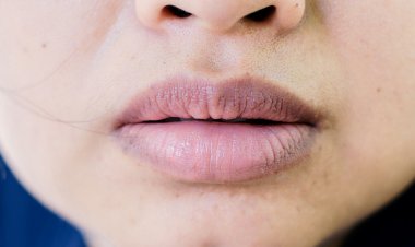 Why do lips turn black, a look at those reasons