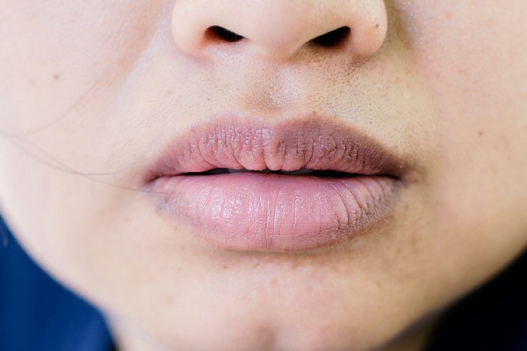 Why do lips turn black, a look at those reasons