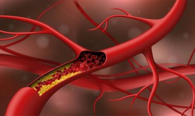 Cholesterol: To control rising cholesterol, eat these things daily in the morning