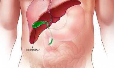 As soon as you see these symptoms, the lovers of alcohol understand that the liver is completely damaged.
