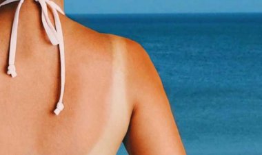 Skin Care: There is a difference in the color of the skin due to strong sunlight, follow these home remedies; skin tone will be fine