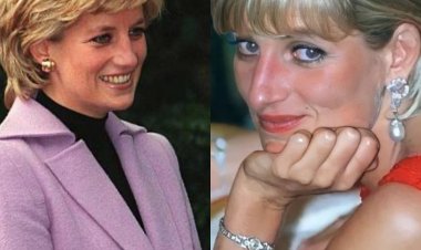 Did you know that Princess Diana was struggling with a skin problem?