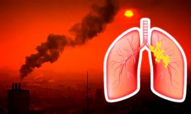 Pollution can be fatal for asthma and bronchitis patients, protect yourself like this