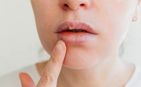 Winter Beauty Care: If your lips are cracked due to cold winds, then make them soft and supple like this.